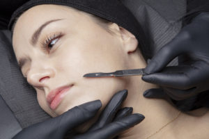 A woman lying down with her head partially covered by a black cloth while a professional in black gloves performs a cosmetic procedure with a scalpel on her face.