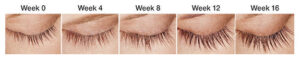 Growth progress from 0 to 12 weeks using Latisse from Lincoln spa on lashes.