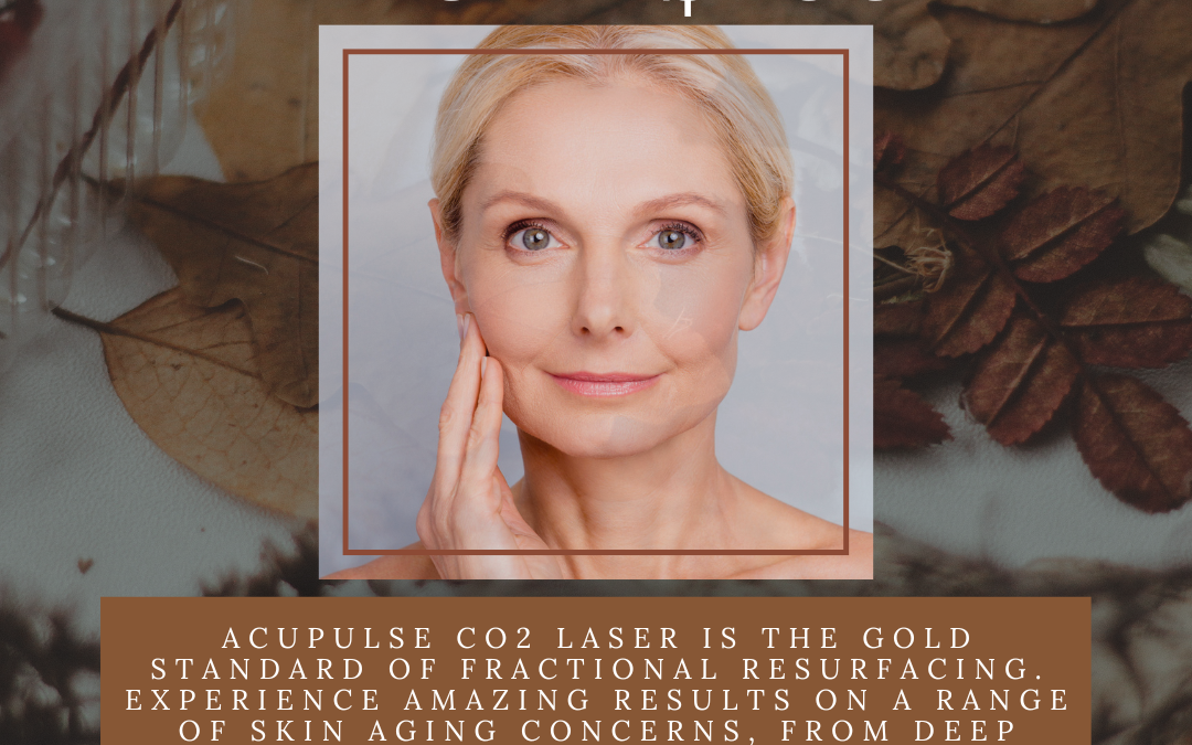 Promotional advertisement featuring a middle-aged woman, offering aculase co2 laser skin resurfacing treatment for $499, highlighting benefits for fine lines and uneven skin texture.
