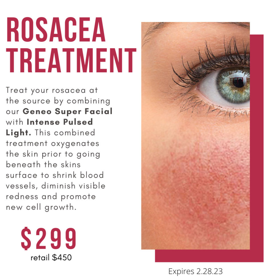 Rosacea Treatment Advanced Skin Body Aesthetics 