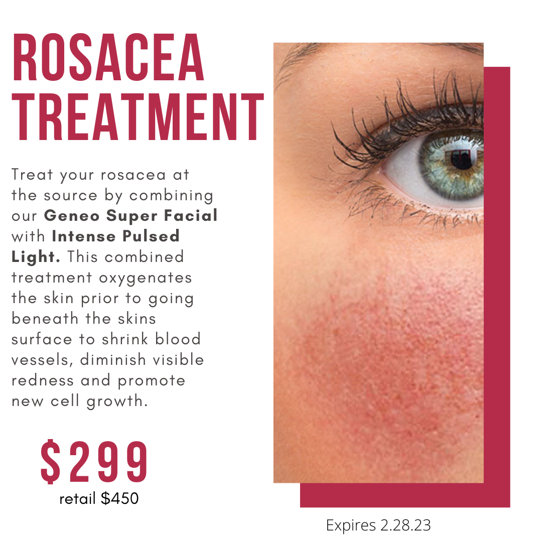Rosacea Treatment 1