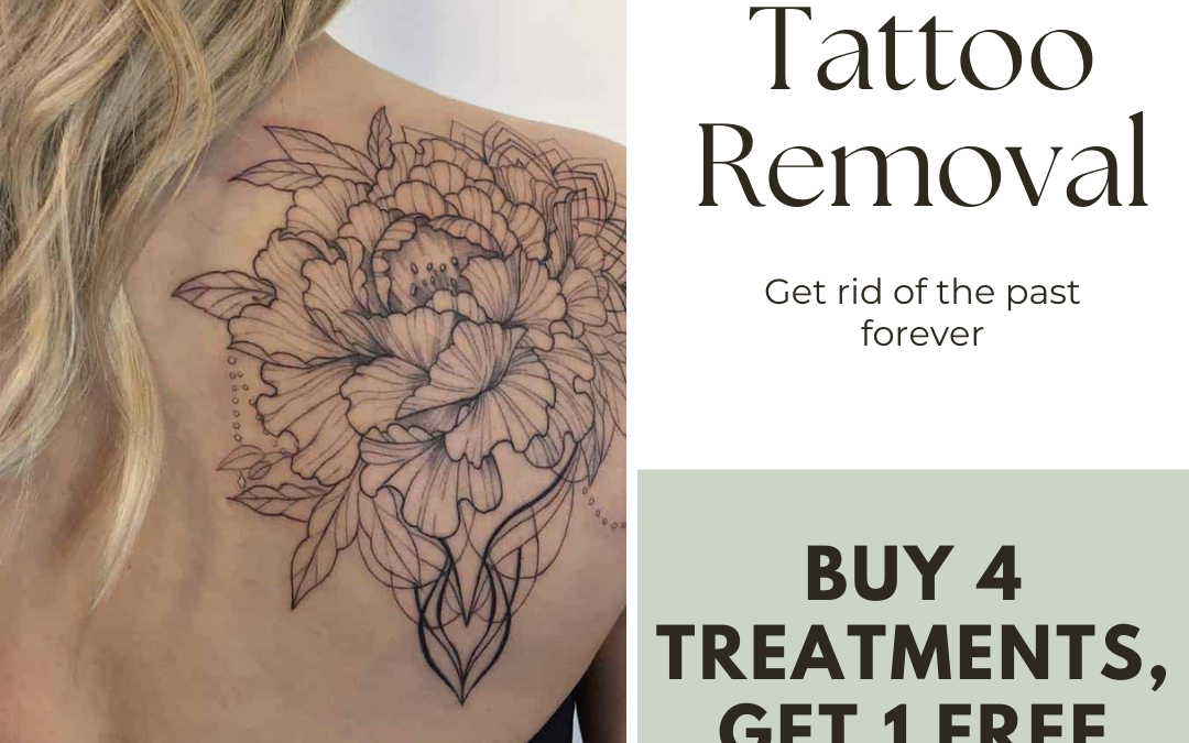 Advertisement for laser tattoo removal services featuring an image of a detailed floral tattoo on a person's shoulder, with a promotion "buy 4, get 1 free" expiring on 3.31.23.