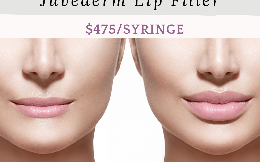Promotional image for juvederm lip filler sale at $475 per syringe, showing close-ups of two women's lower faces, focusing on their lips. "super sale" text and expiry date of 05.31.23 also displayed.